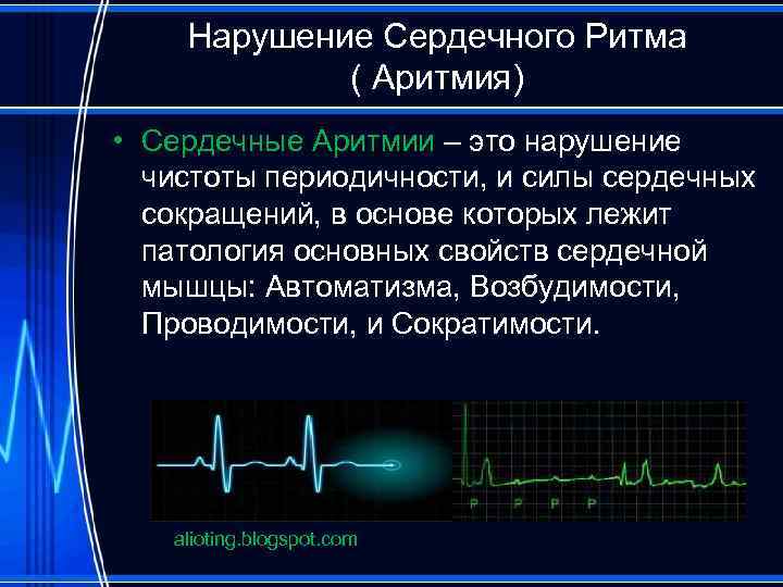 Нормальный ритм. Нарушение ритма сердечных сокращений. Желудочковые нарушения ритма. Ритмичность сердца. Уменьшение сердечного ритма.