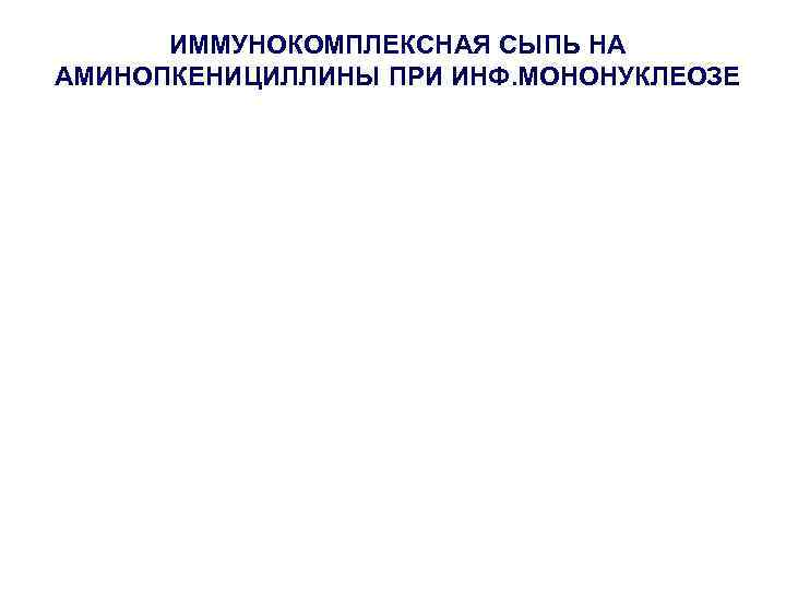 ИММУНОКОМПЛЕКСНАЯ СЫПЬ НА АМИНОПКЕНИЦИЛЛИНЫ ПРИ ИНФ. МОНОНУКЛЕОЗЕ 