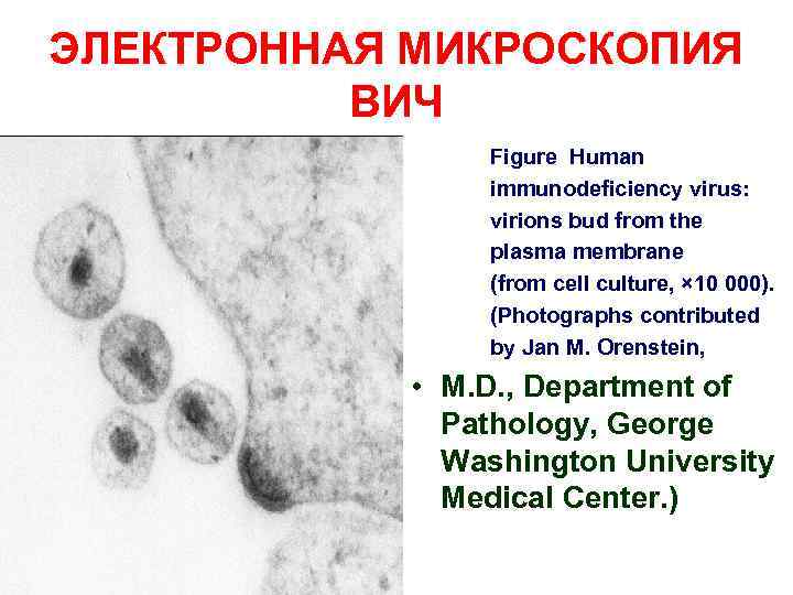 ЭЛЕКТРОННАЯ МИКРОСКОПИЯ ВИЧ Figure Human immunodeficiency virus: virions bud from the plasma membrane (from