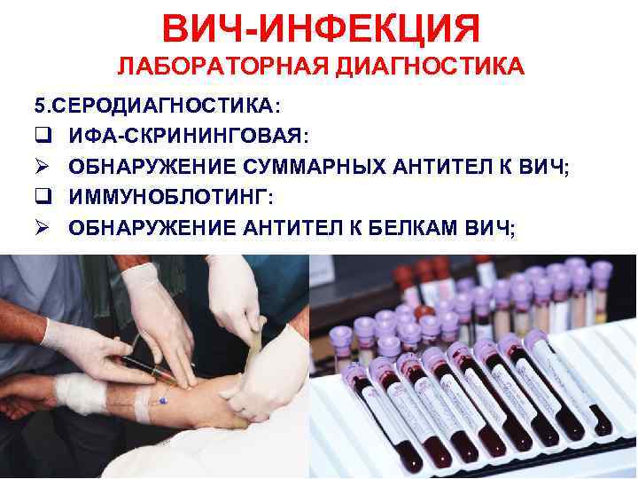 Диагностика вич картинки