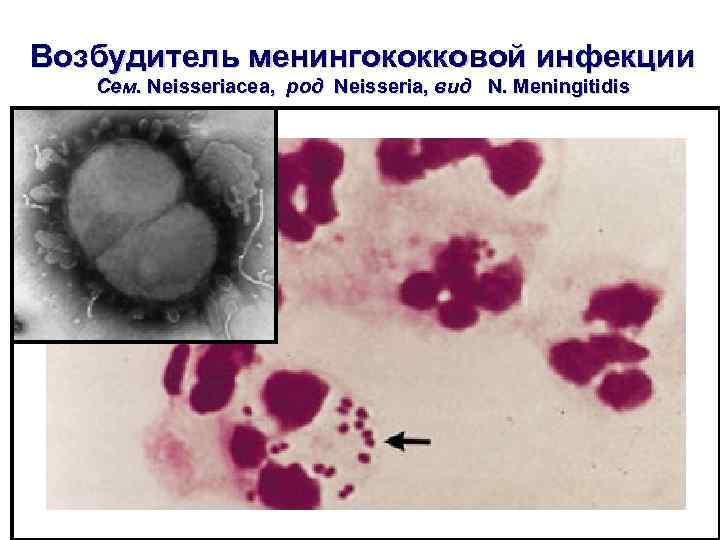 Возбудитель менингококковой инфекции Сем. Neisseriacea, род Neisseria, вид N. Meningitidis 