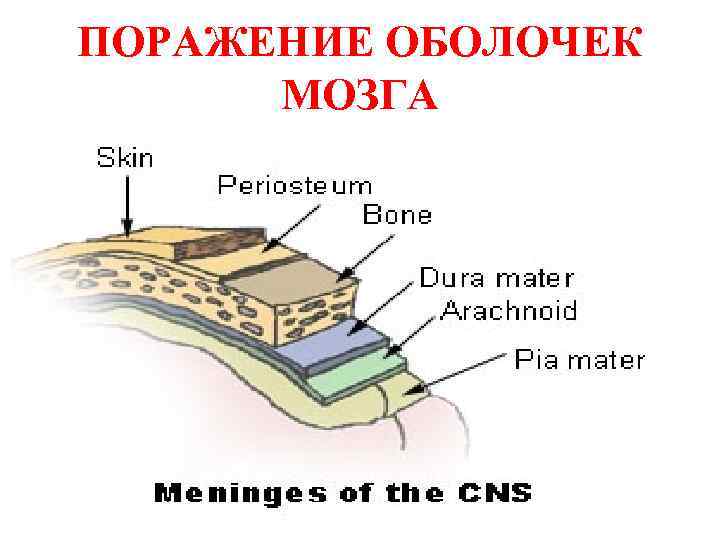 ПОРАЖЕНИЕ ОБОЛОЧЕК МОЗГА 