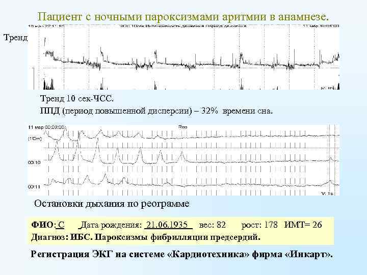 Пациент с ночными пароксизмами аритмии в анамнезе. Тренд 10 сек ЧСС Тренд 10 сек-ЧСС.
