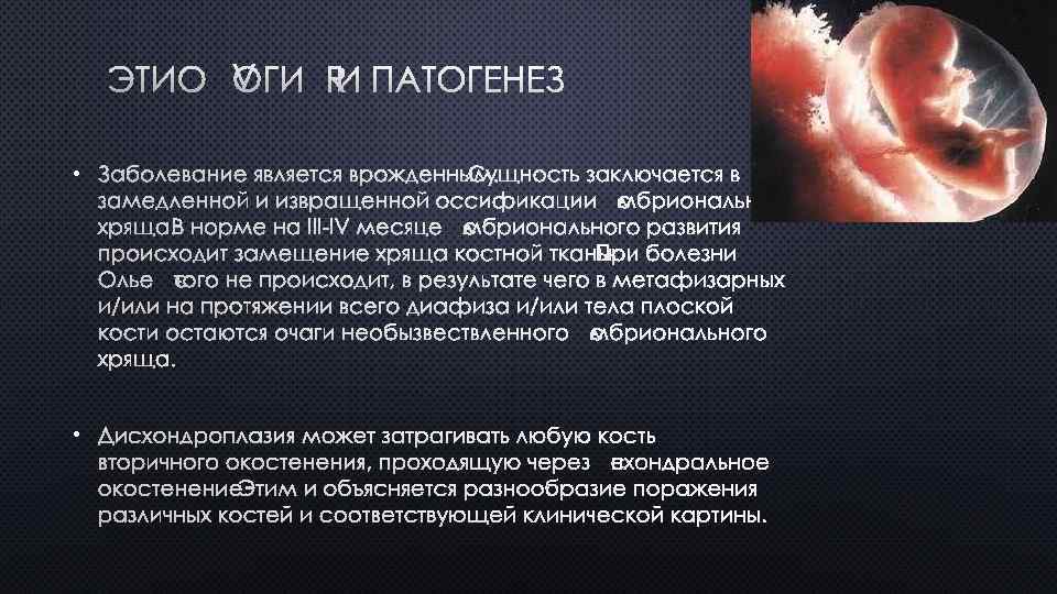 ЭТИОЛОГИЯ И ПАТОГЕНЕЗ • ЗАБОЛЕВАНИЕ ЯВЛЯЕТСЯ ВРОЖДЕННЫМ. СУЩНОСТЬ ЗАКЛЮЧАЕТСЯ В ЗАМЕДЛЕННОЙ И ИЗВРАЩЕННОЙ ОССИФИКАЦИИ