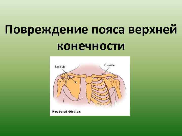 Повреждение пояса верхней конечности 