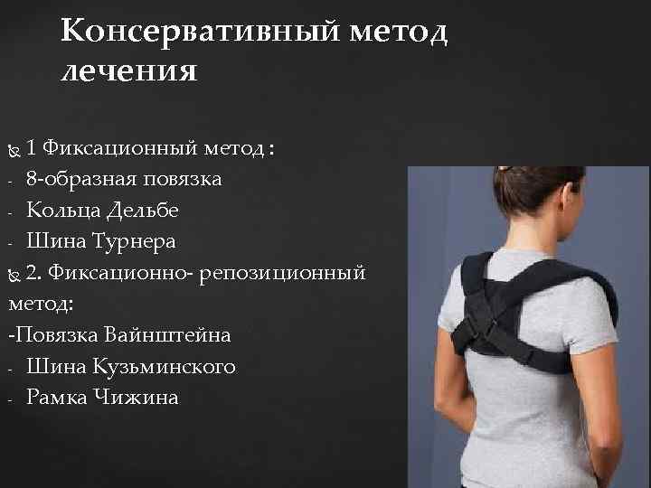 Консервативный метод лечения 1 Фиксационный метод : - 8 -образная повязка - Кольца Дельбе