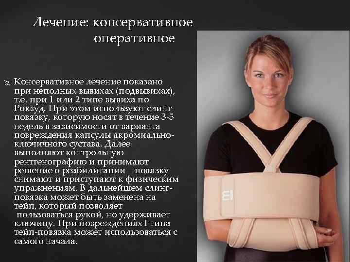 Лечение: консервативное оперативное Консервативное лечение показано при неполных вывихах (подвывихах), т. е. при 1