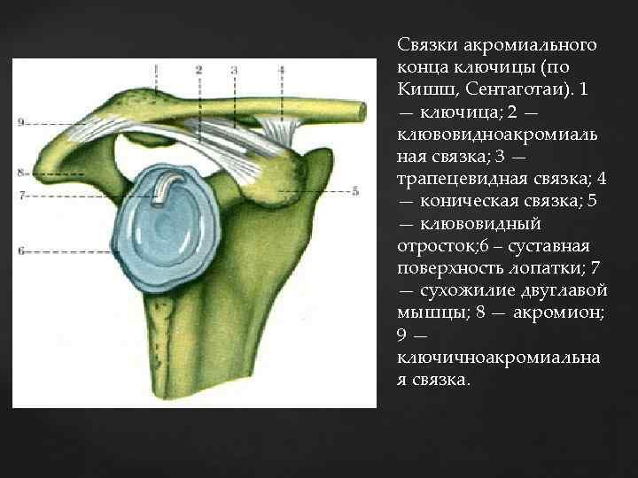 Связки акромиального конца ключицы (по Кишш, Сентаготаи). 1 — ключица; 2 — клювовидноакромиаль ная
