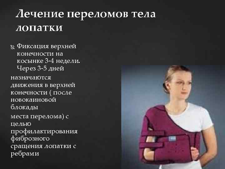 Лечение переломов тела лопатки Фиксация верхней конечности на косынке 3 -4 недели. Через 3