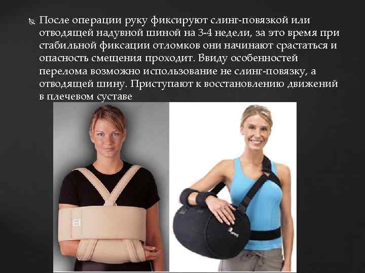  После операции руку фиксируют слинг-повязкой или отводящей надувной шиной на 3 -4 недели,
