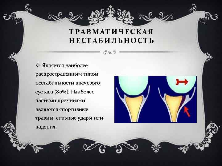 ТРАВМАТИЧЕСКАЯ НЕСТАБИЛЬНОСТЬ v Является наиболее распространенным типом нестабильности плечевого сустава (80%). Наиболее частыми причинами