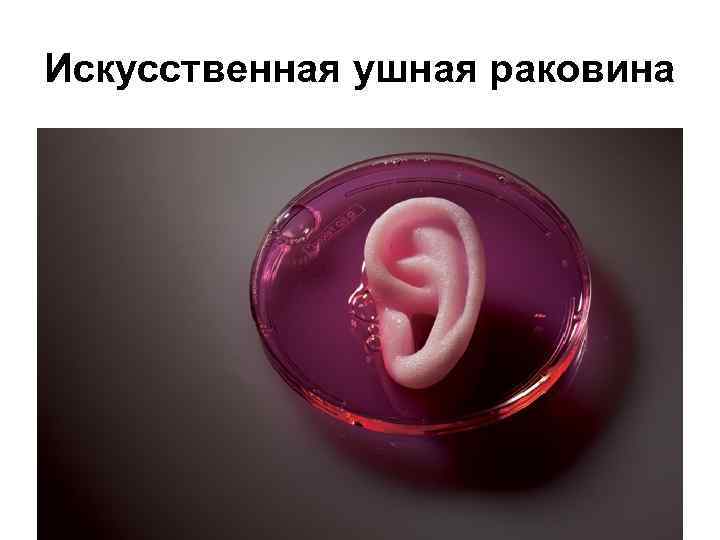 Искусственная ушная раковина 