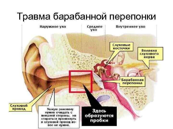 Травма барабанной перепонки 