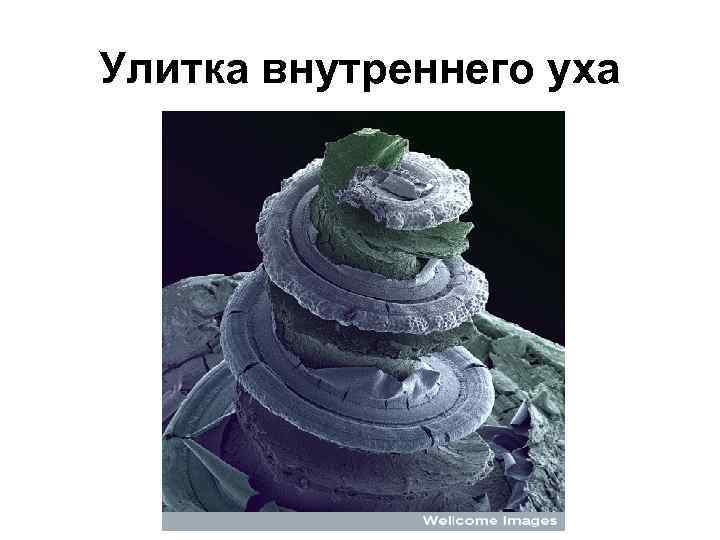 Улитка внутреннего уха 