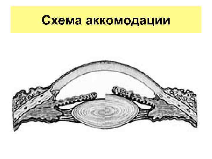 Схема аккомодации 