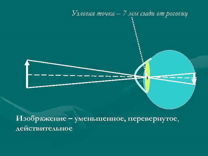 Узловая точка – 7 мм сзади от роговиц Изображение – уменьшенное, перевернутое, действительное 