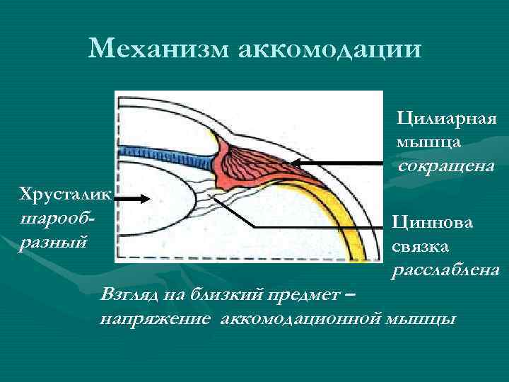 Механизм аккомодации Цилиарная мышца сокращена Хрусталик шарообразный Циннова связка расслаблена Взгляд на близкий предмет