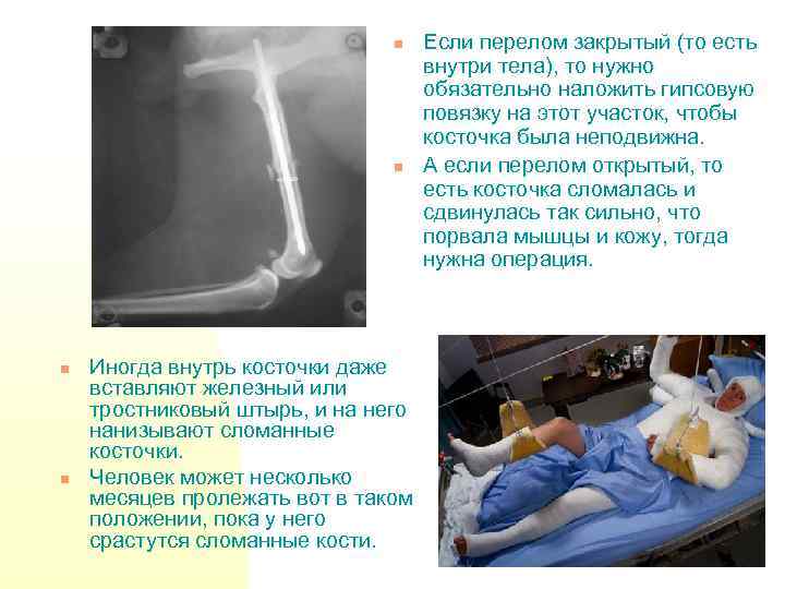 n n Иногда внутрь косточки даже вставляют железный или тростниковый штырь, и на него