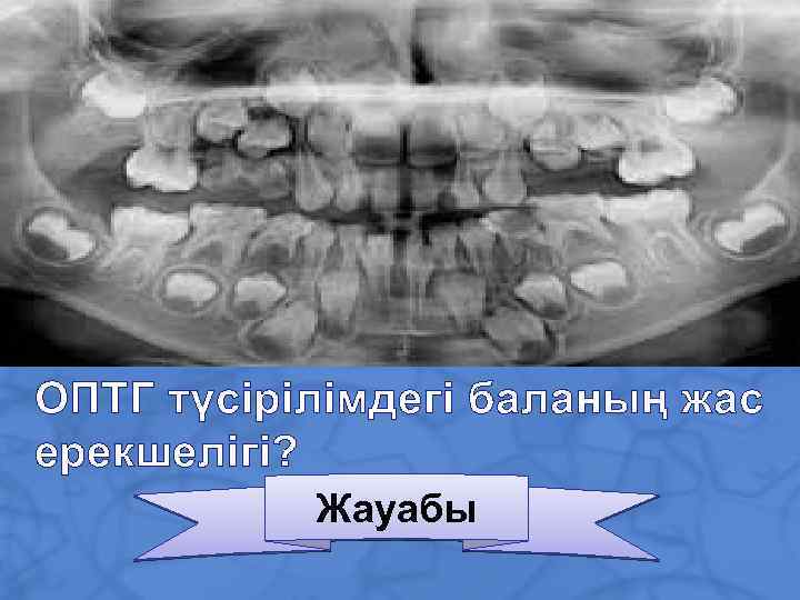 ОПТГ түсірілімдегі баланың жас ерекшелігі? Жауабы 
