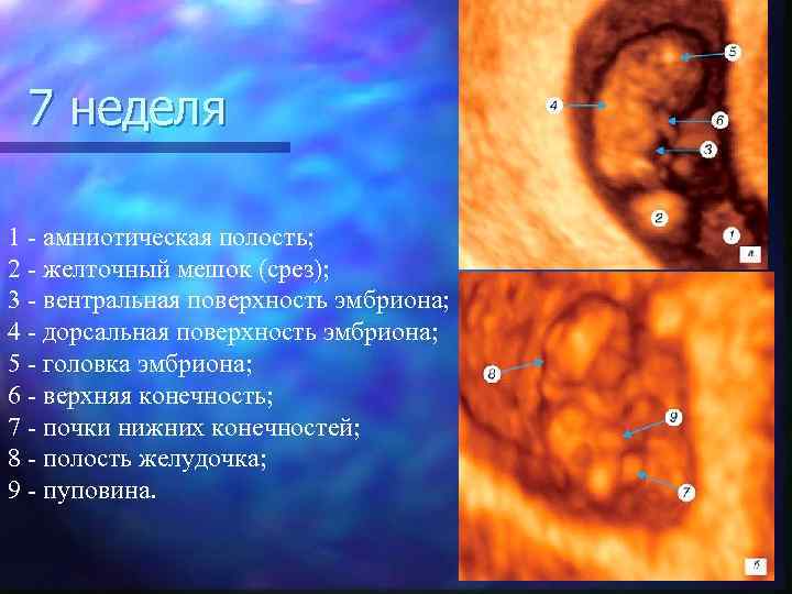 7 неделя 1 - амниотическая полость; 2 - желточный мешок (срез); 3 - вентральная