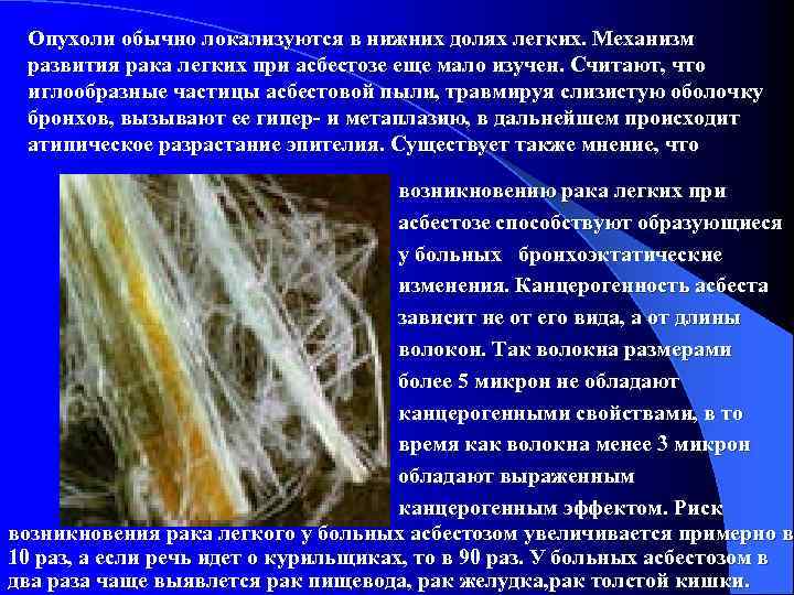 Опухоли обычно локализуются в нижних долях легких. Механизм развития рака легких при асбестозе еще