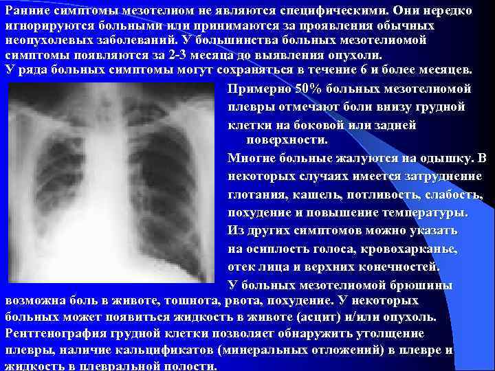 Ранние симптомы мезотелиом не являются специфическими. Они нередко игнорируются больными или принимаются за проявления
