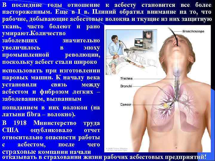 В последние годы отношение к асбесту становится все более настороженным. Еще в I в.