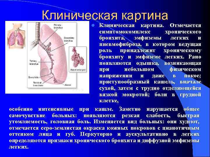 Хобл аускультативная картина