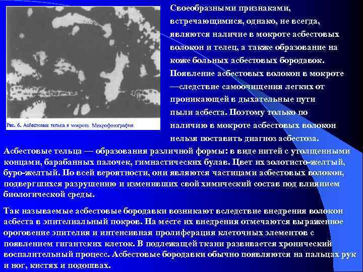 Своеобразными признаками, встречающимися, однако, не всегда, являются наличие в мокроте асбестовых волокон и телец,