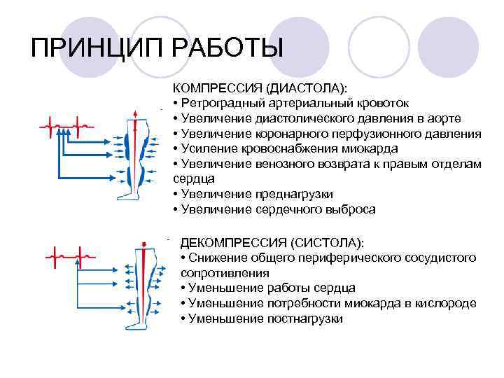 ПРИНЦИП РАБОТЫ КОМПРЕССИЯ (ДИАСТОЛА): • Ретроградный артериальный кровоток • Увеличение диастолического давления в аорте