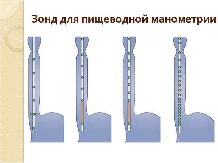 Зонд для пищеводной манометрии 