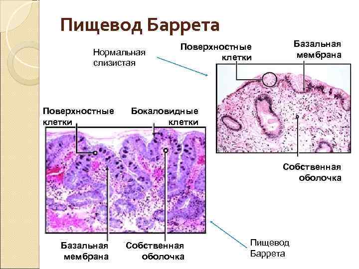 Слизистая оболочка пищевода