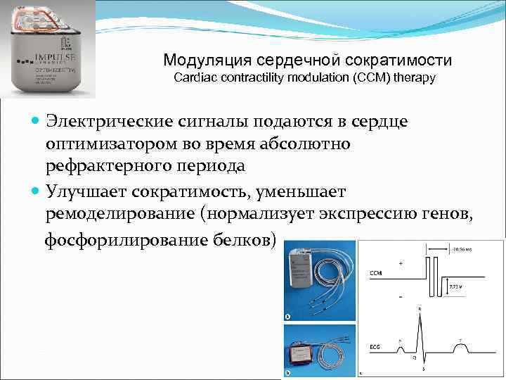 Модуляция сердечной сократимости Cardiac contractility modulation (CCM) therapy Электрические сигналы подаются в сердце