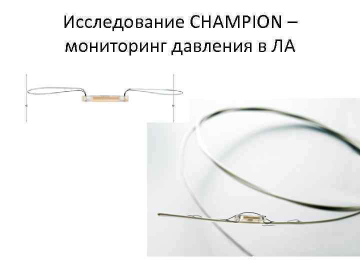 Исследование CHAMPION – мониторинг давления в ЛА 