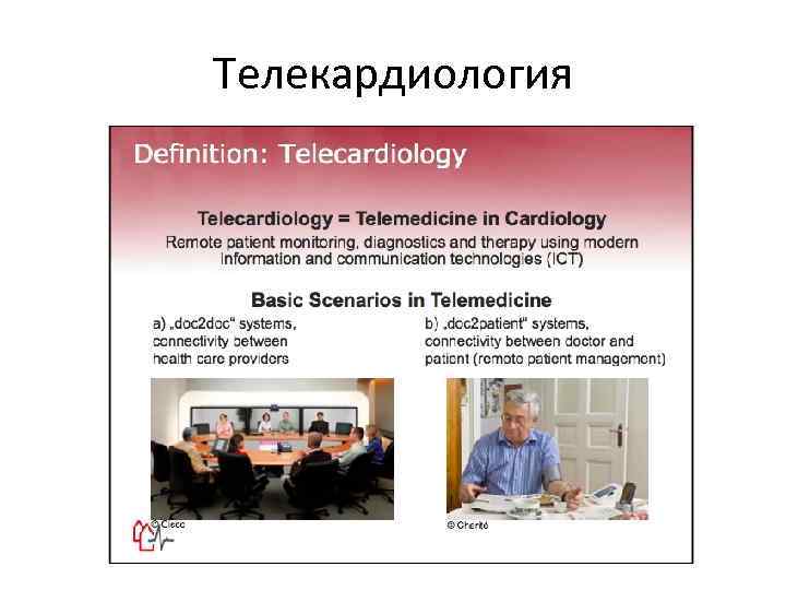 Телекардиология 