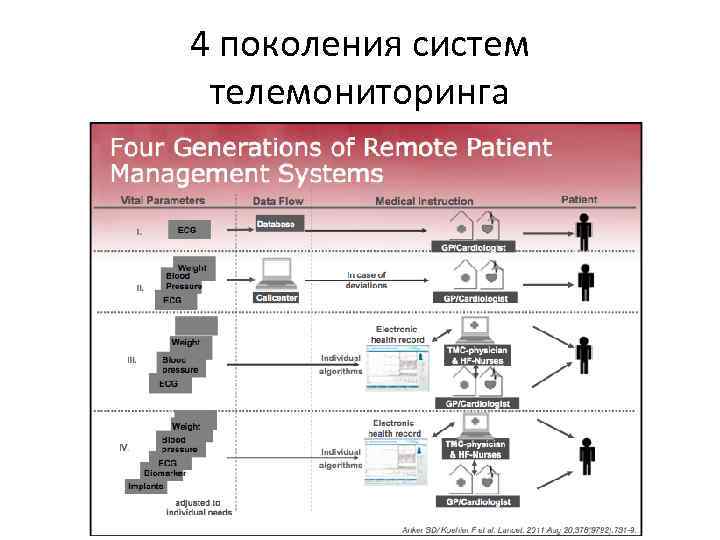 4 поколения систем телемониторинга 
