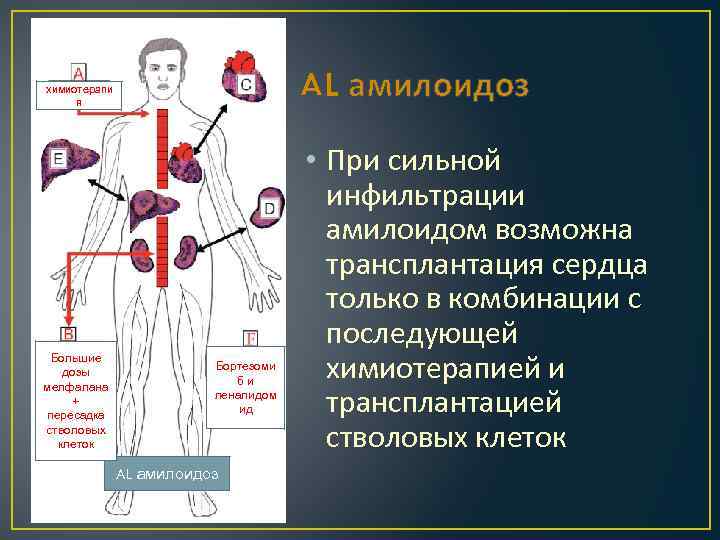 AL амилоидоз химиотерапи я Большие дозы мелфалана + пересадка стволовых клеток Бортезоми би леналидом