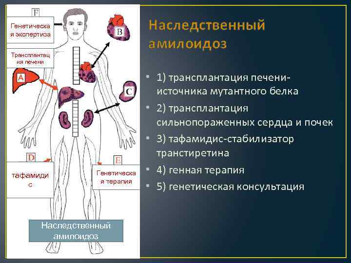 Наследственный амилоидоз Генетическа я экспертиза Трансплантац ия печени тафамиди с Генетическа я терапия Наследственный