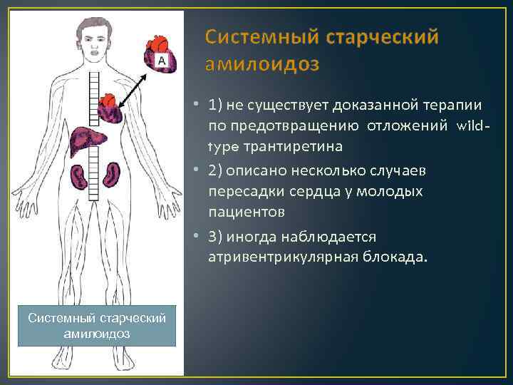 Системный старческий амилоидоз • 1) не существует доказанной терапии по предотвращению отложений wildtype трантиретина