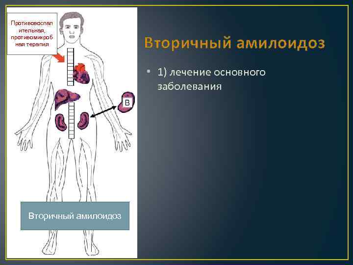 Противовоспал ительная, противомикроб ная терапия Вторичный амилоидоз • 1) лечение основного заболевания Вторичный амилоидоз