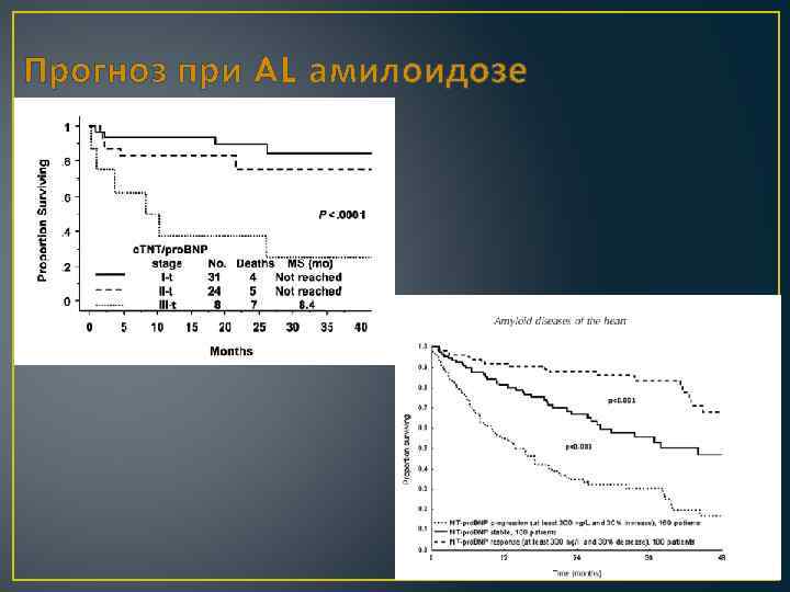 Прогноз при AL амилоидозе 