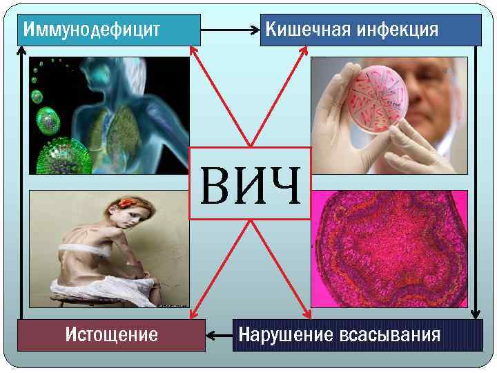 Иммунодефицит Кишечная инфекция ВИЧ Истощение Нарушение всасывания 