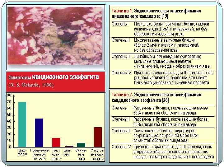 Симптомы кандиозного (R. S. Orlando, 1996) эзофагита 