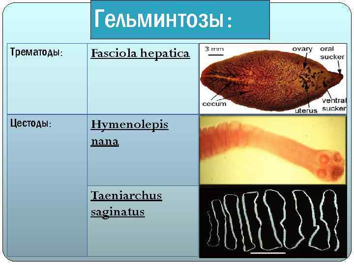 Гельминтозы: Трематоды: Fasciola hepatica Цестоды: Hymenolepis nana Taeniarchus saginatus 