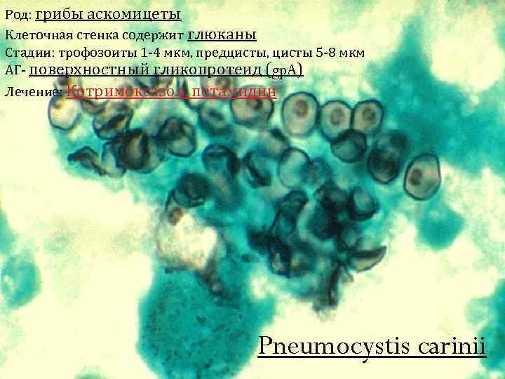 Род: грибы аскомицеты Клеточная стенка содержит глюканы Стадии: трофозоиты 1 -4 мкм, предцисты, цисты