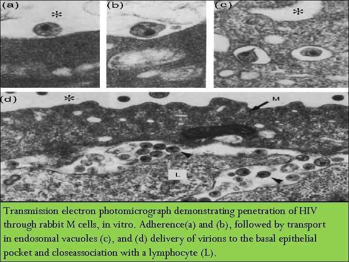 Transmission electron photomicrograph demonstrating penetration of HIV through rabbit M cells, in vitro. Adherence(a)