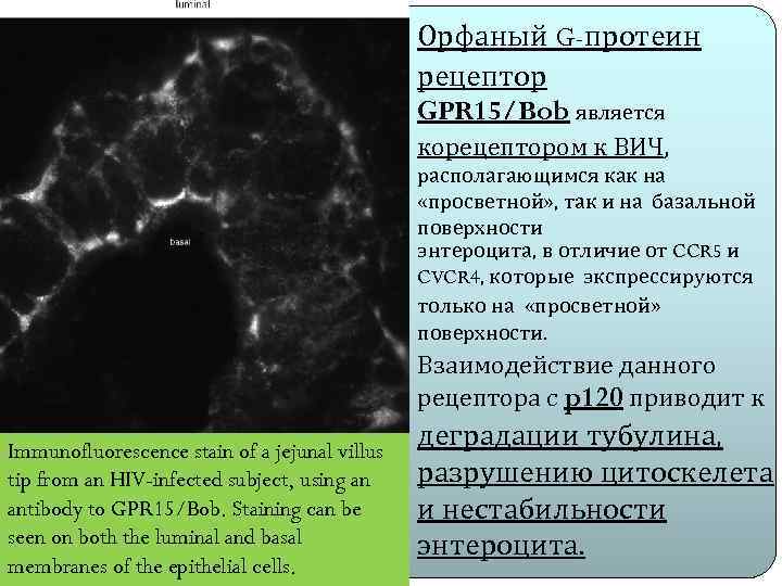 Орфаный G-протеин рецептор GPR 15/Bob является корецептором к ВИЧ, располагающимся как на «просветной» ,