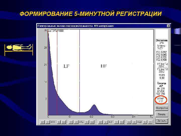 ФОРМИРОВАНИЕ 5 -МИНУТНОЙ РЕГИСТРАЦИИ 