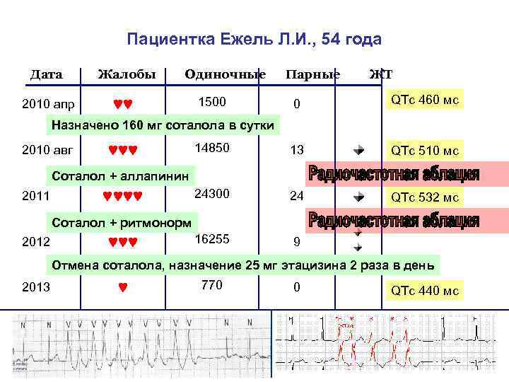 Пациентка Ежель Л. И. , 54 года Дата 2010 апр Жалобы Одиночные ♥♥ Парные