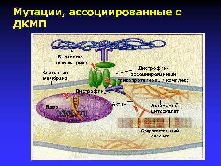 Мутации, ассоциированные с ДКМП Внеклеточный матрикс Дистрофинассоциированный гликопротеиновый комплекс Клеточная мембрана Дистрофин Ядро Актиновый